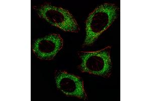 Fluorescent image of U251 cell stained with MAP2K2 Antibody (T394).