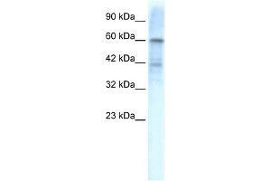 WB Suggested Anti-KCND3 Antibody Titration:  1. (KCND3 Antikörper  (Middle Region))