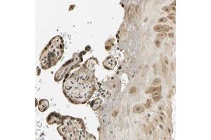 Immunohistochemical staining (Formalin-fixed paraffin-embedded sections) of human placenta with FGF3 polyclonal antibody  shows strong nuclear and cytoplasmic positivity in trophoblastic cells and moderate cytoplasmic positivity in decidual cells. (FGF3 Antikörper  (AA 102-223))