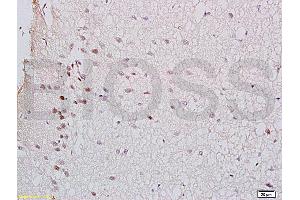 Formalin-fixed and rat brain tissue labeled with Anti-GTPBP10 Polyclonal Antibody (ABIN750748), Unconjugated at 1:200 followed by conjugation to the secondary antibody and DAB staining (GTPBP10 Antikörper  (AA 151-250))