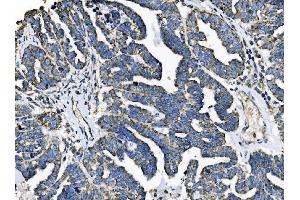 IHC analysis of TOMM70 using anti-TOMM70 antibody (ABIN7599855).