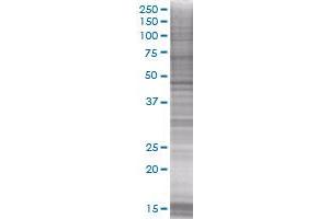 Western Blotting (WB) image for FEN1 293T Cell Transient Overexpression Lysate(Denatured) (ABIN1331814)
