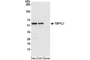 anti-TSPY-Like 1 (TSPYL1) (AA 100-150) antibody