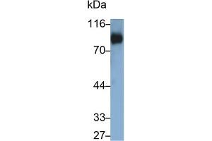Detection of CD42d in Human Platelet lysate using Polyclonal Antibody to Cluster of Differentiation 42d (CD42d) (GP5 Antikörper  (AA 17-242))