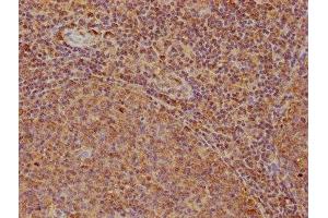 IHC image of ABIN7167999 diluted at 1:200 and staining in paraffin-embedded human tonsil tissue performed on a Leica BondTM system. (ROCK1 Antikörper  (AA 405-668))