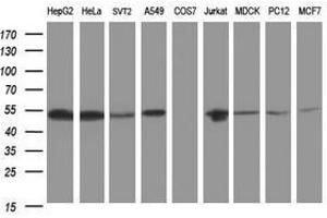Image no. 3 for anti-CD2 (CD2) antibody (ABIN1497194) (CD2 Antikörper)