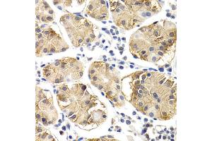 Immunohistochemistry of paraffin-embedded human normal stomach using CHIT1 antibody. (Chitotriosidase 1 Antikörper)
