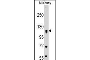 Western blot analysis of anti-MUSK Pab (ABIN392021 and ABIN2841797) in mouse kidney tissue lysates (35 μg/lane). (MUSK Antikörper)