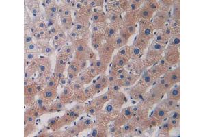 IHC-P analysis of human liver tissue, with DAB staining. (CCL5 Antikörper  (AA 24-91))