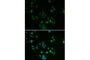 Immunofluorescence analysis of MCF7 cell using BCL2 antibody. (Bcl-2 Antikörper)