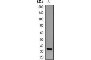 Western blot analysis of CD158i expression in HEK293T (A) whole cell lysates. (KIR2DS4 Antikörper)