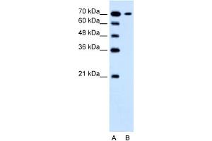 WB Suggested Anti-SLC5A4 Antibody Titration:  1. (SLC5A4 Antikörper  (N-Term))