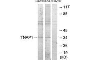 Western blot analysis of extracts from HuvEc cells, treated with PMA 125ng/ml 30', using TNAP1 Antibody. (TNFAIP1 Antikörper  (AA 71-120))