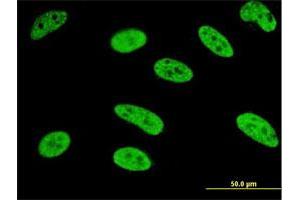 Immunofluorescence of monoclonal antibody to MEF2A on HeLa cell. (MEF2A Antikörper  (AA 71-170))