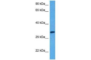 Host:  Rabbit  Target Name:  SLC29A3  Sample Tissue:  Human Uterus Tumor lysates  Antibody Dilution:  1ug/ml (SLC29A3 Antikörper  (C-Term))