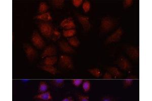 Immunofluorescence analysis of HeLa cells using HRNR Polyclonal Antibody at dilution of 1:100 (40x lens). (HRNR Antikörper)