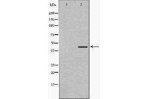 Western blot analysis of Smad7 expression in Human Kidney lysate,The lane on the left is treated with the antigen-specific peptide. (SMAD7 Antikörper  (N-Term))