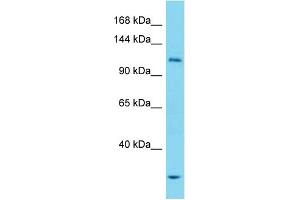 Western Blotting (WB) image for anti-Unc-51 Like Kinase 1 (ULK1) (N-Term) antibody (ABIN2785618) (ULK1 Antikörper  (N-Term))