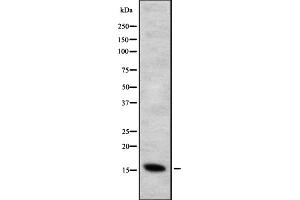Western blot analysis of CYB5B expression in HEK293 cells ,The lane on the left is treated with the antigen-specific peptide. (CYB5B Antikörper  (Internal Region))