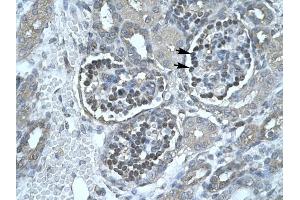 Lipase antibody (Pancreatic) was used for immunohistochemistry at a concentration of 4-8 ug/ml to stain Epithelial cells of renal corpuscle (lndicated with Arrows) in Human Kidney. (PNLIP Antikörper  (C-Term))