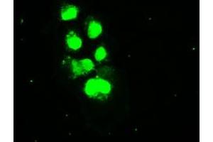 Anti-SSB mouse monoclonal antibody (ABIN2452278) immunofluorescent staining of COS7 cells transiently transfected by pCMV6-ENTRY SSB (RC205013). (SSB Antikörper)