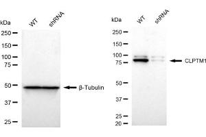 Western blotting analysis using CLPTM1 antibody (ABIN7798098).