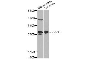 Western blot analysis of extracts of various cell lines, using RPP30 antibody (ABIN6290883) at 1:1000 dilution. (RPP30 Antikörper)