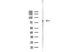 anti-Adenosine Deaminase, RNA-Specific, B2 (ADARB2) antibody