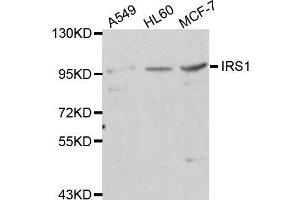 Western blot analysis of extracts of various cell lines, using IRS1 antibody. (IRS1 Antikörper)