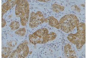 ABIN6273650 at 1/100 staining Human uterus tissue by IHC-P.