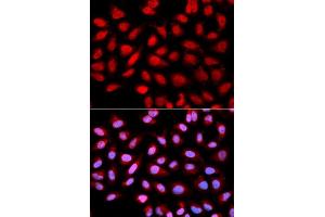 Immunofluorescence analysis of U2OS cells using PPP2R4 antibody (ABIN5970981).