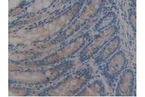 IHC-P analysis of Mouse Large Intestine Tissue, with DAB staining.