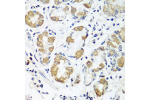 Immunohistochemistry of paraffin-embedded human stomach using OXCT1 antibody at dilution of 1:100 (40x lens).