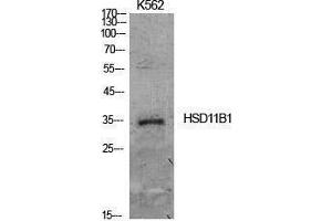 Western Blotting (WB) image for anti-Hydroxysteroid (11-Beta) Dehydrogenase 1 (HSD11B1) (Internal Region) antibody (ABIN3181414) (HSD11B1 Antikörper  (Internal Region))