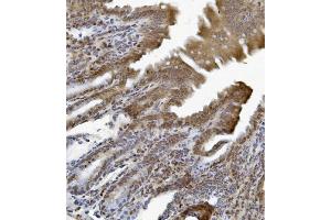 IHC analysis of ETF/TEAD2 using anti-ETF/TEAD2 antibody (ABIN7599879). (TEAD2 Antikörper  (AA 125-398))
