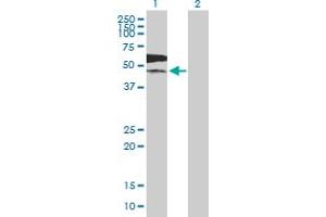 Western Blot analysis of PKLR expression in transfected 293T cell line by PKLR MaxPab polyclonal antibody. (PKLR Antikörper  (AA 1-574))