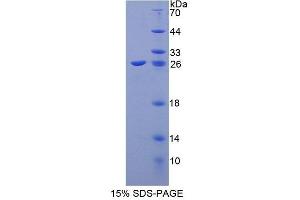 SDS-PAGE analysis of Human CIB1 Protein.