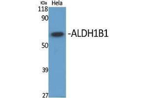 Western Blot (WB) analysis of specific cells using ALDH1B1 Polyclonal Antibody. (ALDH1B1 Antikörper  (Internal Region))