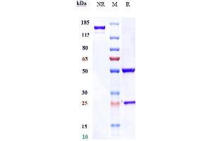 anti-AXL (Enapotamab Biosimilar) antibody