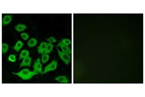 Immunofluorescence analysis of A549 cells, using RPL36 antibody. (RPL36 Antikörper  (Internal Region))