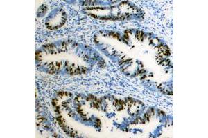 Immunohistochemistry (IHC) image for anti-Zinc Finger E-Box Binding Homeobox 2 (ZEB2) (N-Term) antibody (ABIN7299564)