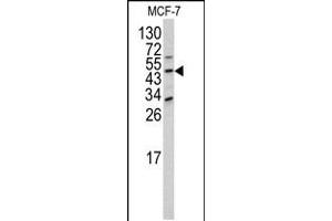 Western blot analysis of DOM3Z antibody (N-term Y88) in MCF-7 cell line lysates (35ug/lane) (DOM3Z Antikörper  (N-Term))