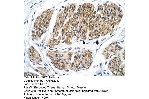 Human Smooth Muscle (NFKB2 Antikörper  (C-Term))