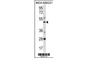 SPIB Antibody (C-term) (ABIN1881823 and ABIN2838428) western blot analysis in MDA-M cell line lysates (35 μg/lane). (SPIB Antikörper  (C-Term))