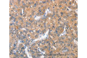 Immunohistochemistry of Human brain  using KEL Polyclonal Antibody at dilution of 1:40 (KEL Antikörper)
