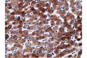 Immunohistochemical staining of paraffin-embedded Human liver tissue using anti-CD80 mouse monoclonal antibody. (CD80 Antikörper)