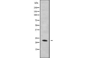 Western blot analysis GAS3 using MDA-MB-435 whole cell lysates (PMP22 Antikörper  (C-Term))