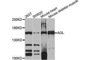 Western blot analysis of extracts of various cells, using AGL antibody. (AGL Antikörper)