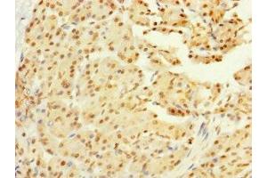 Immunohistochemistry of paraffin-embedded human pancreatic tissue using ABIN7160672 at dilution of 1:100 (GALK2 Antikörper  (AA 161-458))