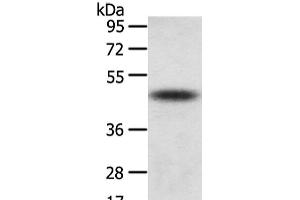 Western Blot analysis of Mouse adrenal gland tissue using TTC23 Polyclonal Antibody at dilution of 1/800 (TTC23 Antikörper)